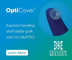 OptiCover, the First Shelf-Stable Lyophilized Amniotic Graft Containing HC-HA/PTX3 Designed for Efficient Workflow for Patients with Mild-to-Moderate Dry Eye